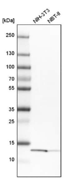 YBEY Antibody, Novus Biologicals 25 &mu;L | Buy Online | Novus Biologicals | Fisher Scientific